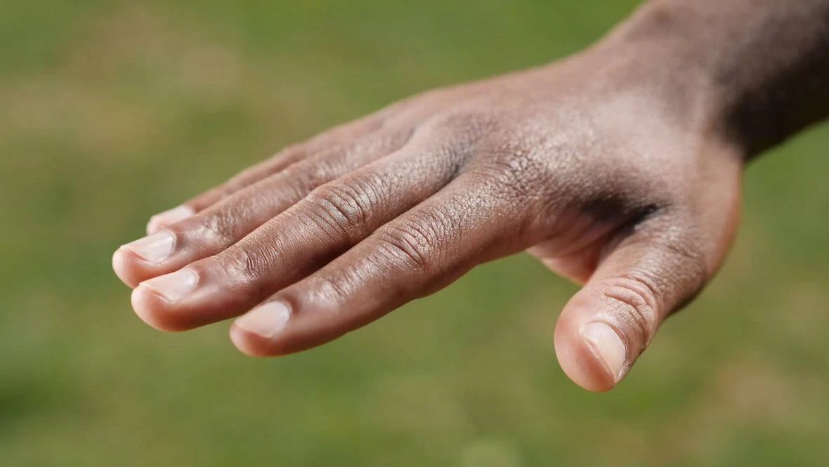 Finger Surgery Recovery Exercises FitBeast
