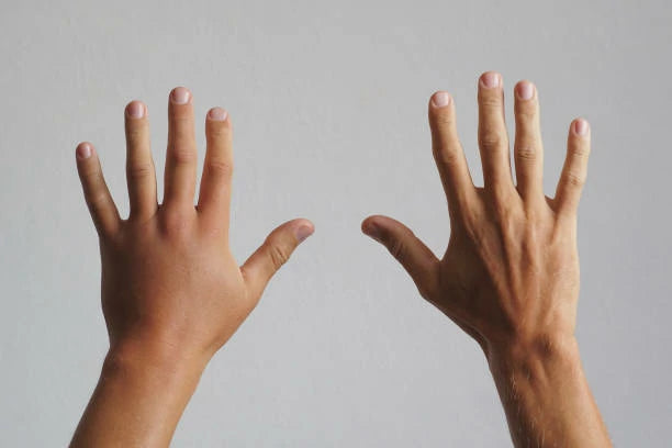 Introducing Effective Index Finger Rehabilitation Exercises for Improved Hand Function and Recovery