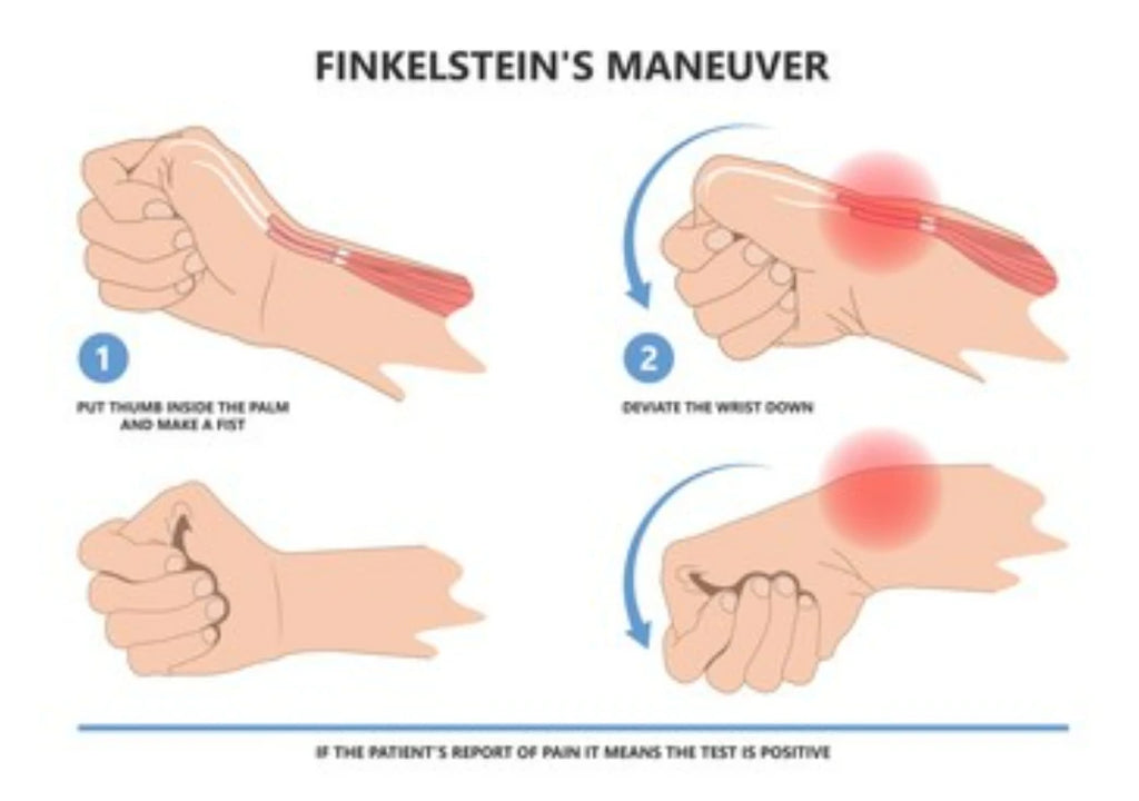 hand and finger rehab exercises