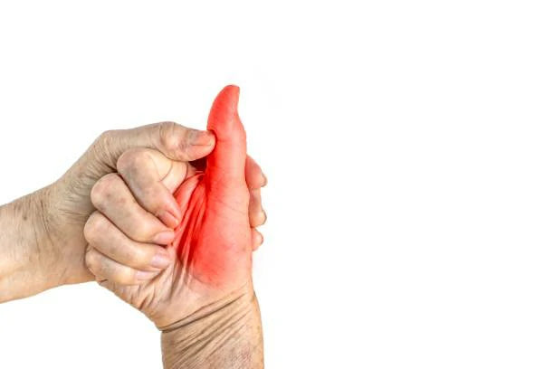 Physical Therapy Exercises for Dislocated Finger – FitBeast